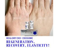 reglory-exo-1
