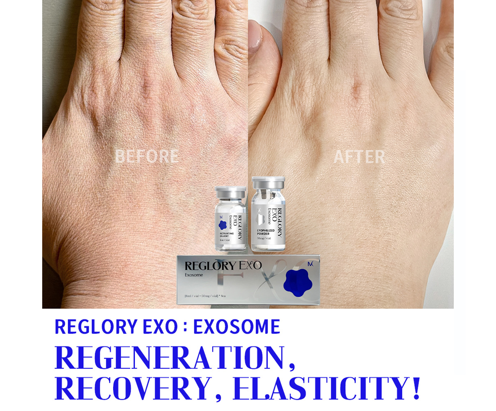 reglory-exo-1